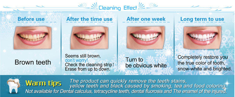 teeth-whitening-home-kit-effective-remove-the-teeth-stains