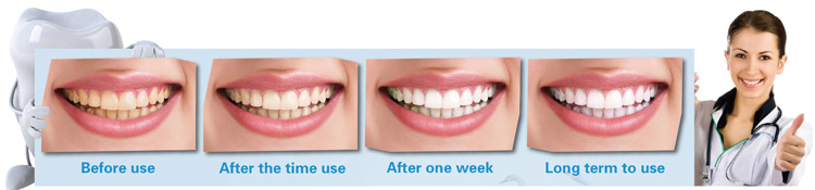 Home Kits Magic teeth brush instant teeth whitening perfect white teeth effect
