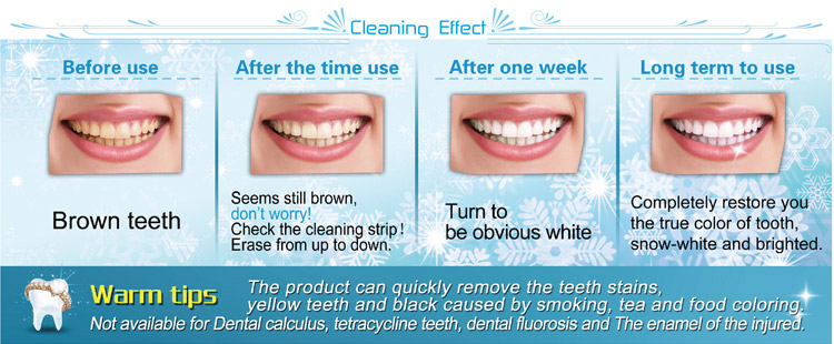 Professional Teeth Whitening Kits at Home,power cleaning effection