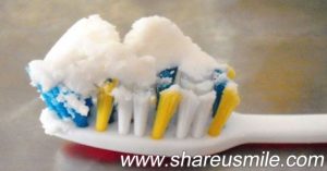 coconut-oil-for-teeth professional teeth whitening on shareusmile.com