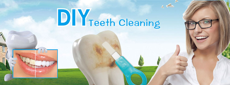 shareusmile-Magic-teeth-cleaning-kit-is-an-innovative-DIY-teeth-whitening-kit