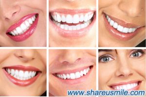 The-natural-color-of-teeth-Some-people's-teeth-are-milky,-some-people-are-light-yellow,-all-these-are-healthy more details on www.shareusmile.com