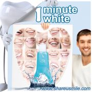 shareusmile SH012-professional Teeth Cleaning Kit -help-maintain-a-high-level-of-personal-oral