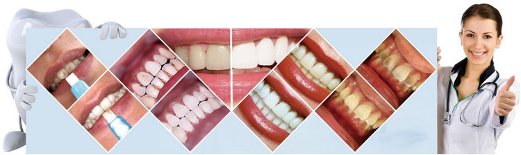 various teeth whitening New Creative Products Dental Whitening with custom logo